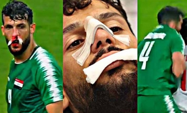 طبيب المنتخب يطمئن الجماهير على سعد ناطق