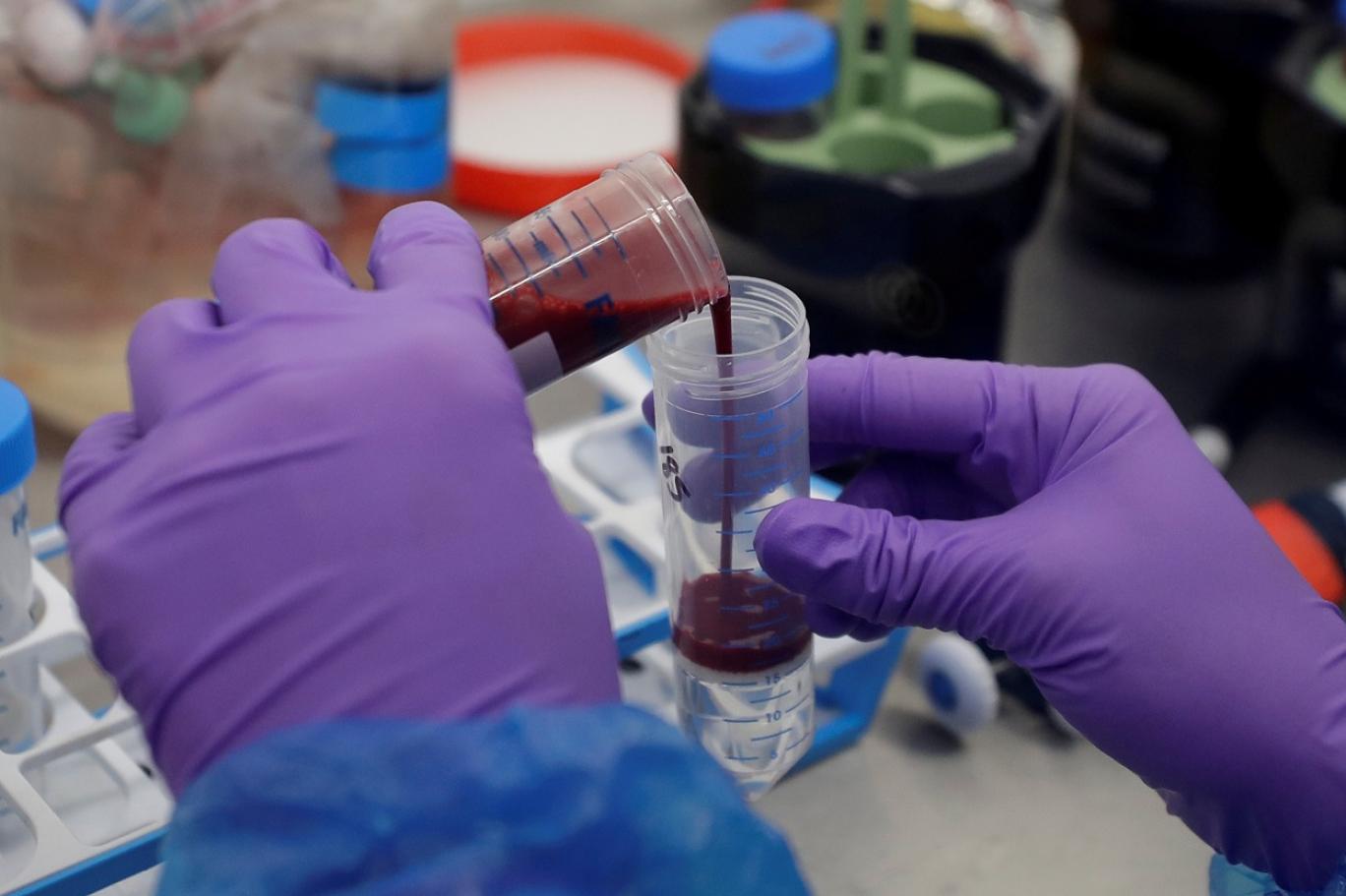 تحليل دم “يرصد سرطان الثدي قبل سنتين من التشخيص”