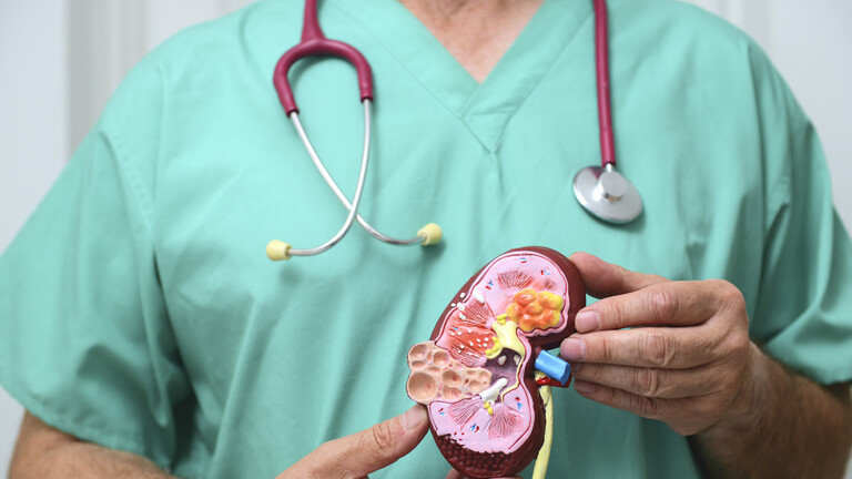 ادوية متاحة تبعث أملا جديدا في علاج سرطان الكلى